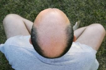 سایز ناحیه بدون مو